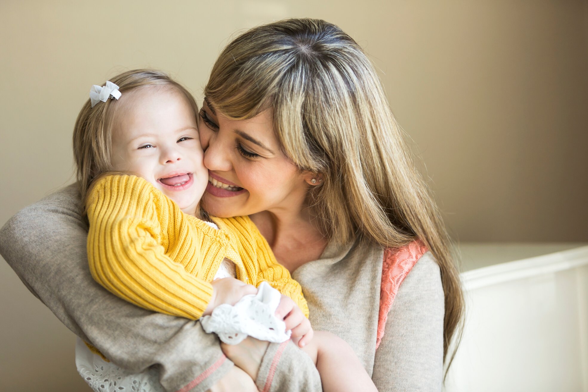 Mother and daughter with down syndrome